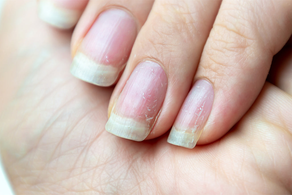 From ridges to white spots - what your nails reveal about your health and  risk of silent killers | The US Sun