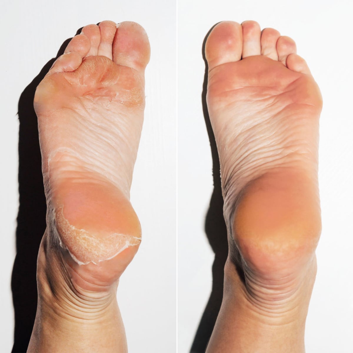 Dream Feet (special)