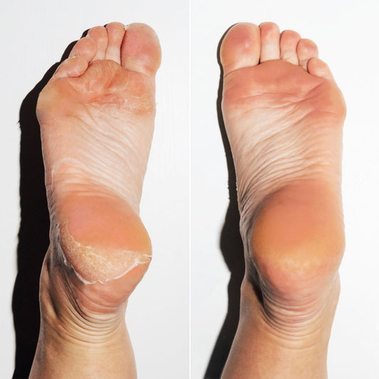 Dream Feet (special)